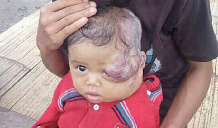 Mengidap Tumor, Bayi Ini Butuh Doa dan Uluran Tangan
